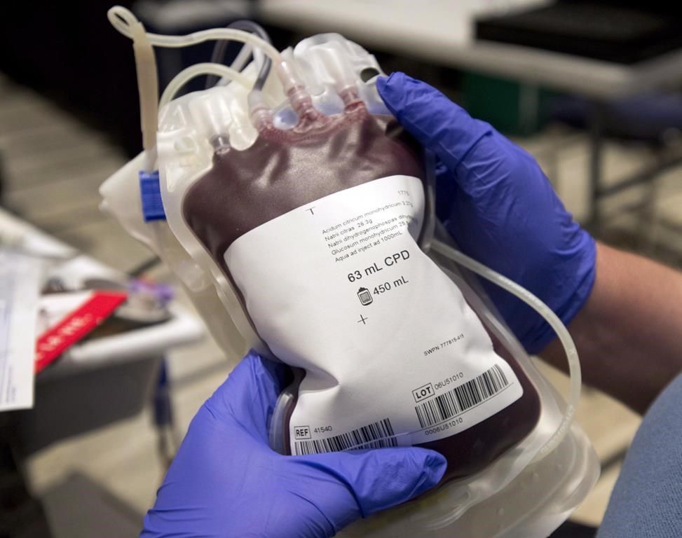 La Société canadienne du sang envisage les dons rémunérés de plasma